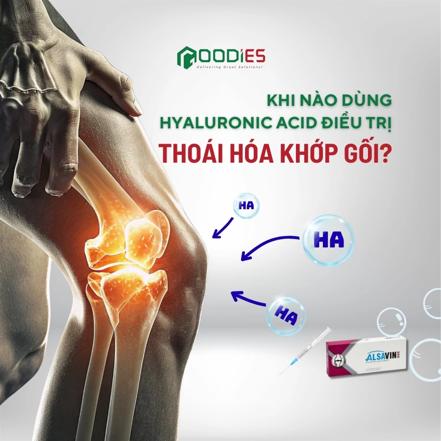 KHI NÀO CÓ THỂ DÙNG HYALURONIC ACID ĐIỀU TRỊ THOÁI HÓA KHỚP GỐI?