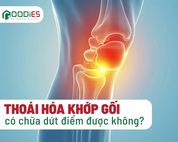  THOÁI HÓA KHỚP GỐI CÓ CHỮA DỨT ĐIỂM ĐƯỢC KHÔNG?