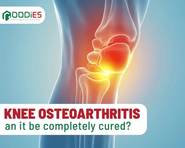 Can Knee Osteoarthritis Be Completely Cured?