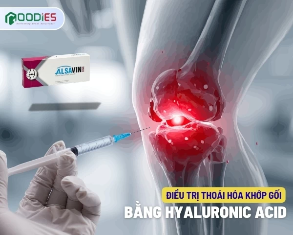 ĐIỀU TRỊ THOÁI HÓA KHỚP GỐI BẰNG HYALURONIC ACID (HA)