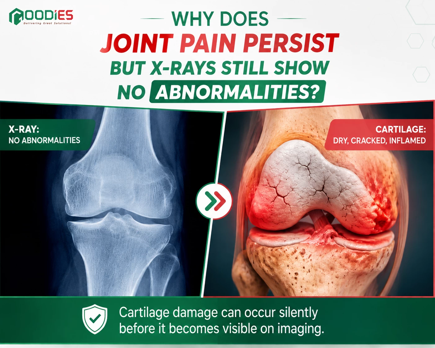 PERSISTENT JOINT PAIN DESPITE “MILD” X-RAY FINDINGS – WHY DOES IT STILL HURT SO MUCH?